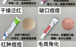 wis祛痘印凝胶过敏怎么办？