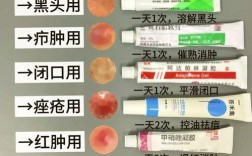 本草纲目药膏祛痘真的有效吗？