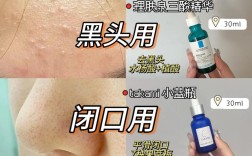 柠檬水洗脸真能祛痘吗？