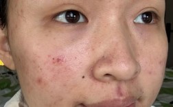 朴妆蛋蛋祛痘效果到底好不好？