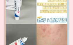 小林制药祛痘膏怎么用才有效？