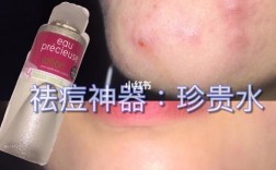 珍贵水祛痘效果真的好吗？