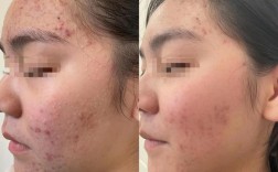 护肤品会导致畸形吗？