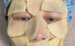 土豆敷脸祛痘多久能见效？