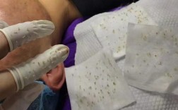 契氏祛痘啫喱用后发黑？