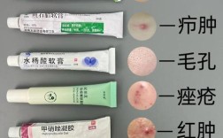 医院能买到祛痘药水吗？