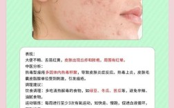 祛痘要注意哪些问题？