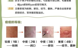 祛痘祛痘印，怎么快见效？