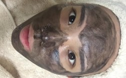 黑脸娃娃祛痘印效果真的好吗？