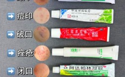 中药祛痘膏含激素吗？