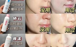 自制补水喷雾能祛痘印吗？