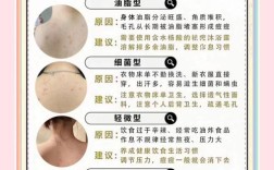 脖子上长痘怎么办？快速祛痘方法有哪些？