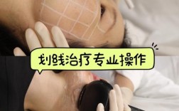 上海激光祛痘美莱效果怎么样？