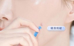 粉刺针消毒就能祛痘？靠谱吗？