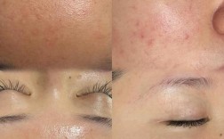 护肤VS不护肤，差距到底有多大？