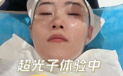 OPT冷光祛痘效果好吗？