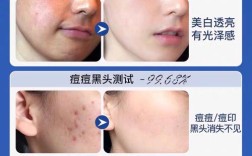 祛斑祛痘洗面奶真的有效吗？