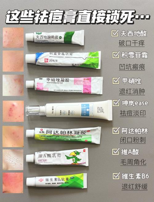 Clean Clear祛痘凝胶真的能快速祛痘不留印吗？-图2