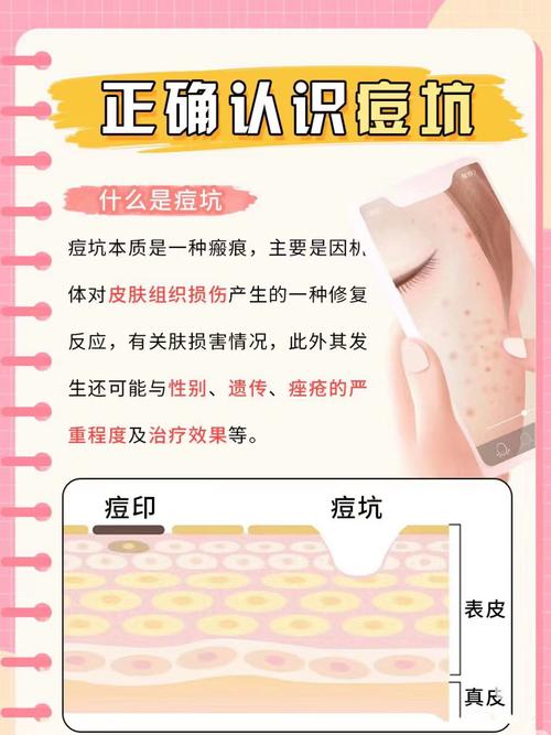 Skinlife祛痘原理是什么？-图1