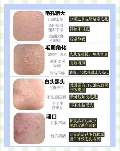 毛孔粗大黑头，该用啥护肤品？-图1