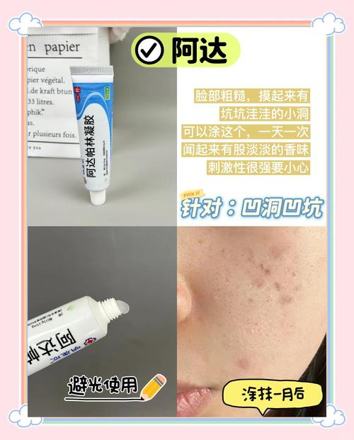 bedook祛痘膏能去痘印吗？-图3
