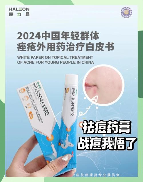 阿达帕林凝胶祛痘效果到底好不好？-图2