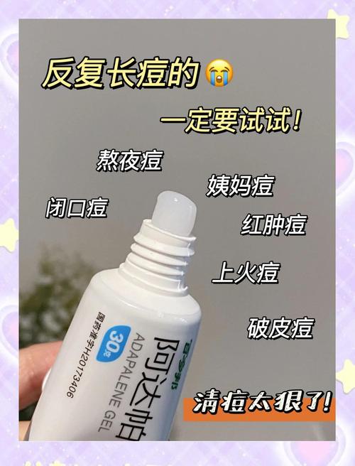 阿达帕林凝胶祛痘效果到底好不好？-图3