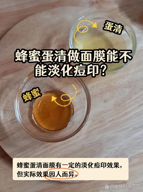 蛋清自制祛痘面膜怎么做?-图1 蛋清自制祛痘面膜怎么做?-图1