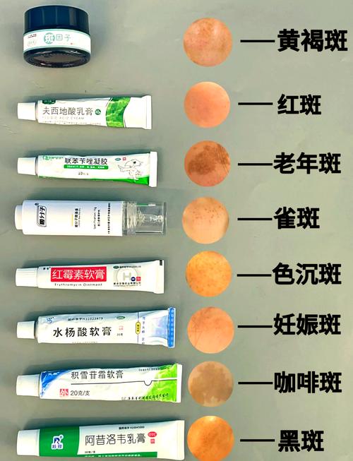脸上有黄褐斑，用什么护肤品能淡斑？-图1
