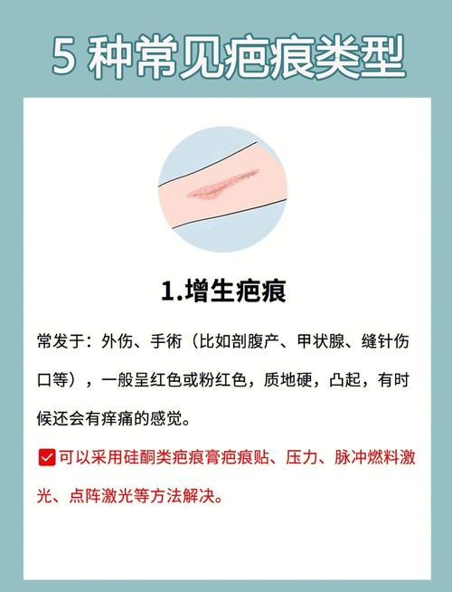 长春祛痘疤最有效的方法是啥？-图3