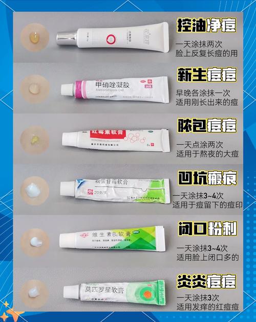 男士油痘皮祛痘印，选啥产品见效快？-图2