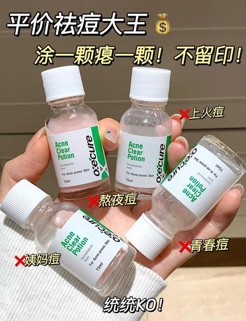 泰国祛痘产品哪款真有效？-图1