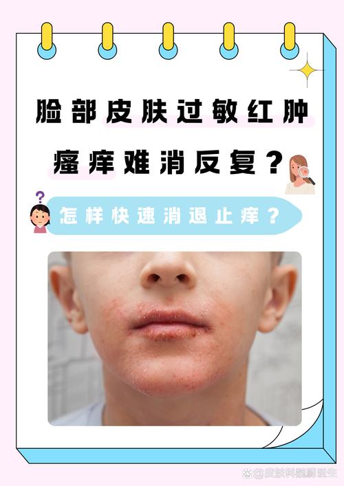 护肤品过敏脸痒肿,急救方法有哪些?-图3 护肤品过敏脸痒肿,急救方法有哪些?-图3