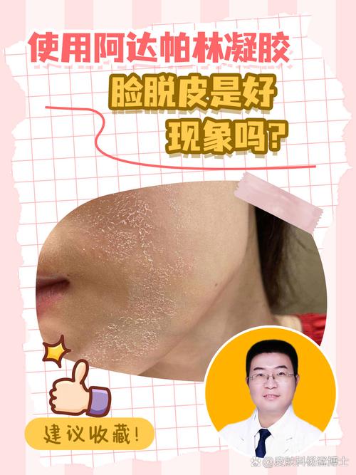 用泰国的祛痘霜脸上脱皮-图2 用泰国的祛痘霜脸上脱皮-图2