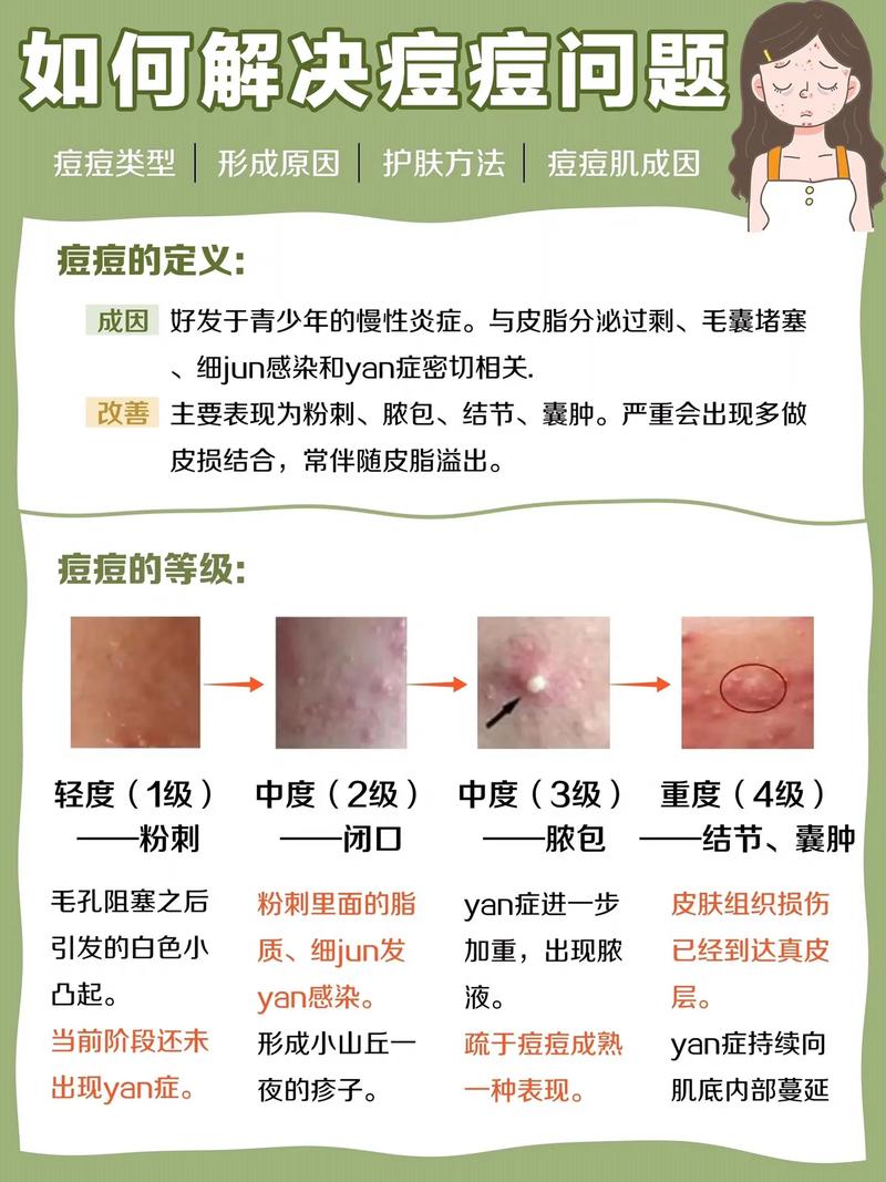 专业祛痘护肤的正确方法究竟是什么?-图2 专业祛痘护肤的正确方法究竟是什么?-图2