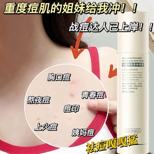 补水祛痘喷雾哪个品牌最有效？-图3