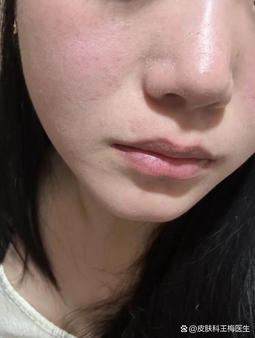 护肤品过敏症状有哪些？-图2