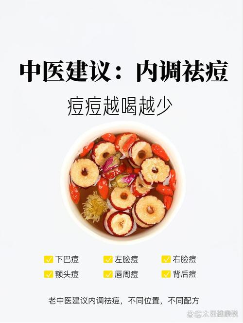 春天喝什么饮品能祛痘？-图3