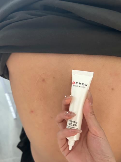 背部磨砂祛痘选什么产品好?-图2 背部磨砂祛痘选什么产品好?-图2