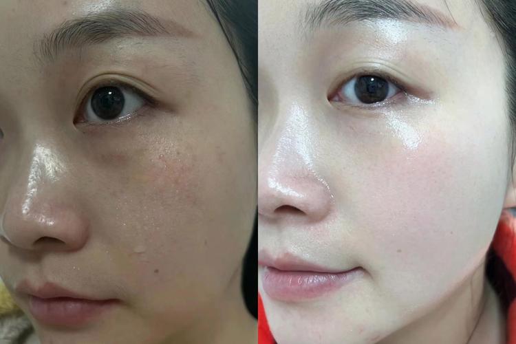 20岁女生护肤品怎么选？-图1