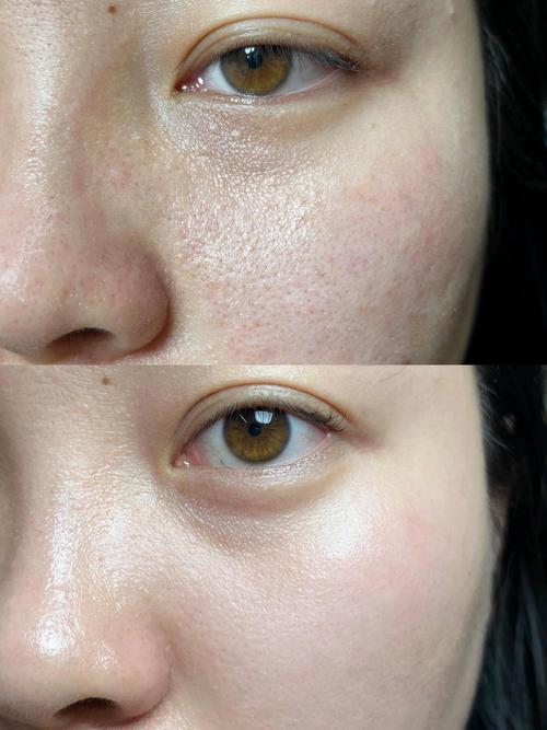 毛孔粗大该选啥护肤品？-图3