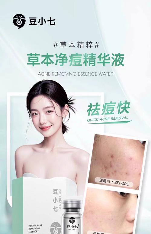 控油祛痘爽肤水到底哪个好用？-图3