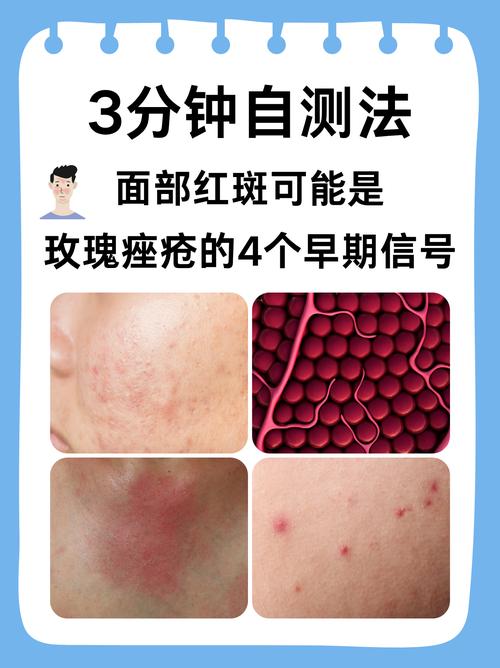 海尔滨九红祛斑祛痘效果真的有那么好吗？-图2