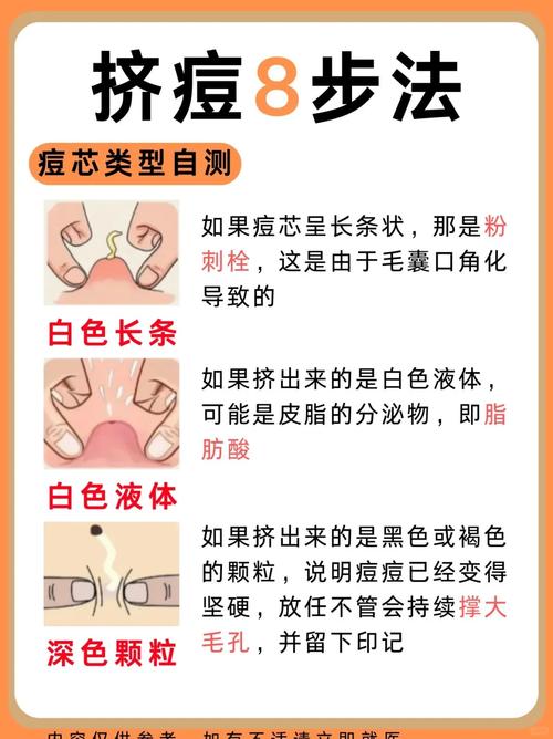 祛痘印痘疤，怎样才有效？-图3