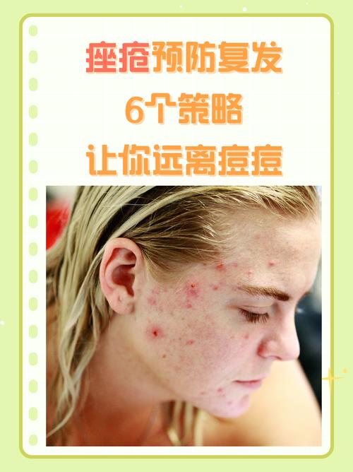 murad祛痘会爆痘吗-图1