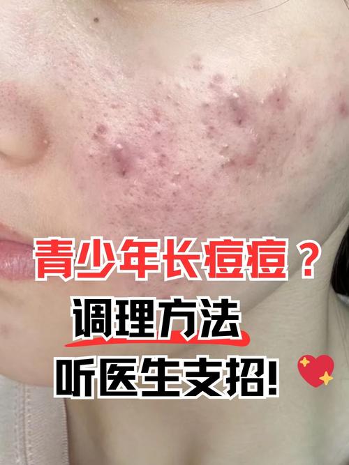 murad祛痘会爆痘吗-图2