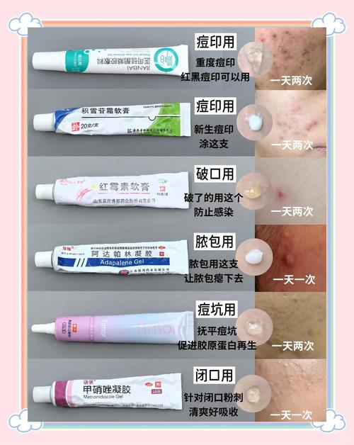 wis祛痘印凝胶正确用法是什么?-图2 wis祛痘印凝胶正确用法是什么?-图2