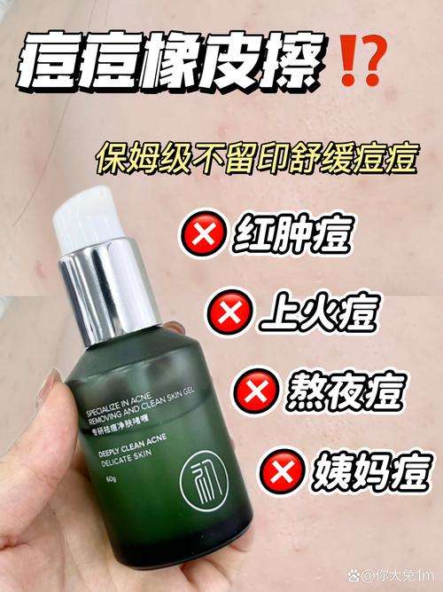 伊思ac祛痘系列效果真的好吗?-图1 伊思ac祛痘系列效果真的好吗?-图1