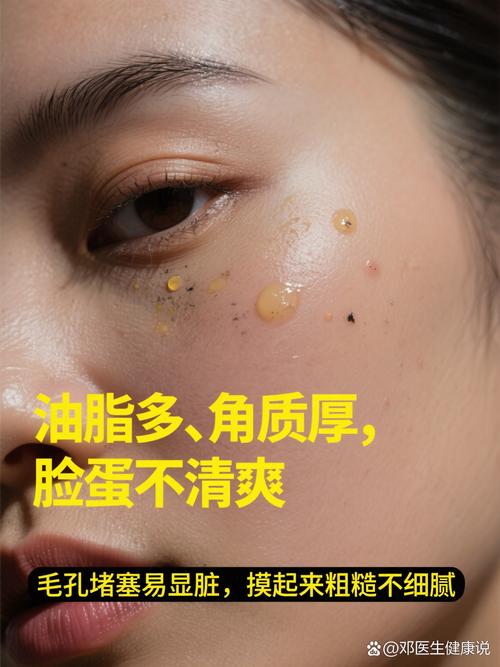 白醋祛痘洗脸怎么用才正确？-图2