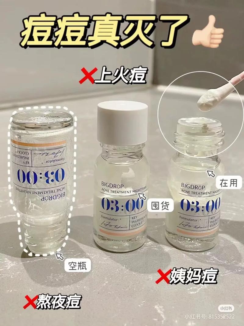 没有痘痘可以用祛痘水-图3